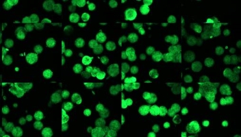 ATI, Advanced Technology High Throughput Screening (Fluorescence Scanner) ezScan 1