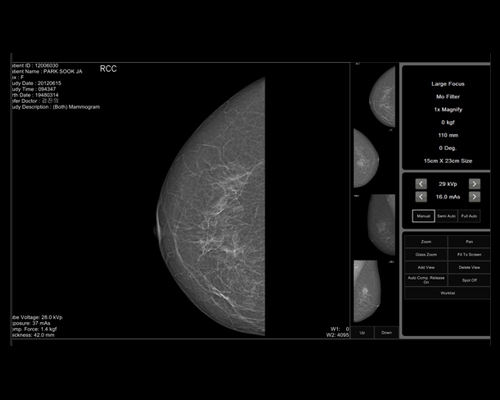 GENORAY Mammography DMX-600 2