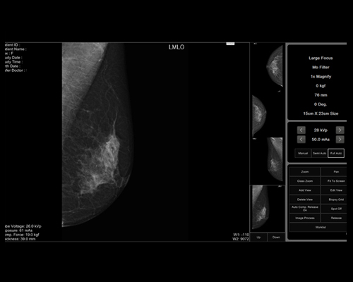 GENORAY Mammography DMX-600 1