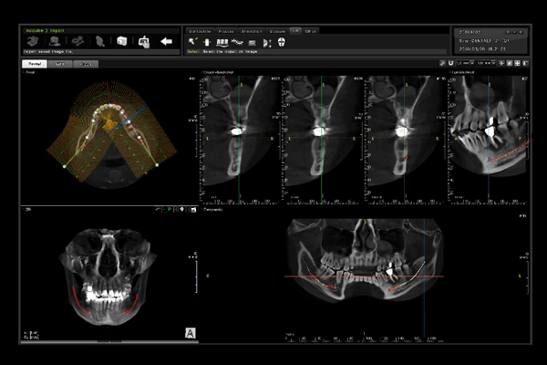 GENORAY Software Program TRIANA 1