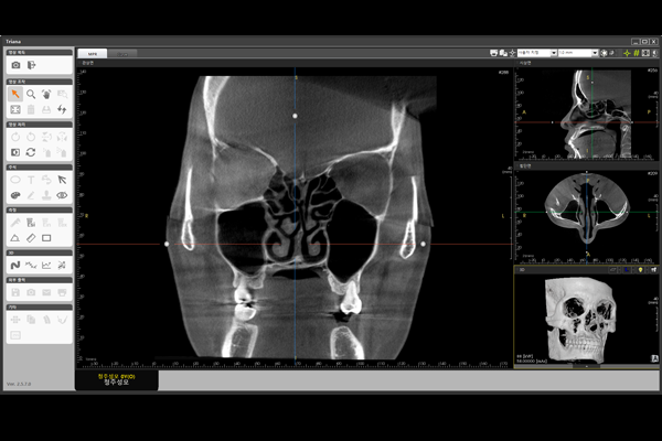 (주)제노레이 디지털 3D CT PAPAYA 3D ENT 5