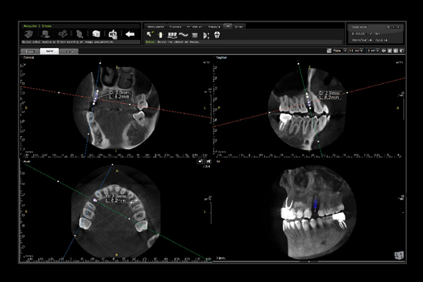 GENORAY Software Program TRIANA 3