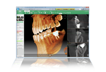 치과용 영상전송 장치 소프트웨어