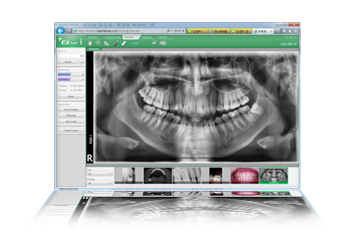 치과용 영상전송 장치 소프트웨어